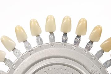 Various shades of tooth-colored fillings in Aston PA